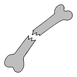 Gebrochen