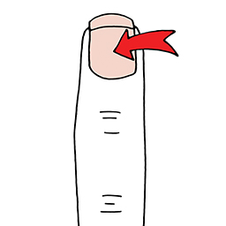 Nagel